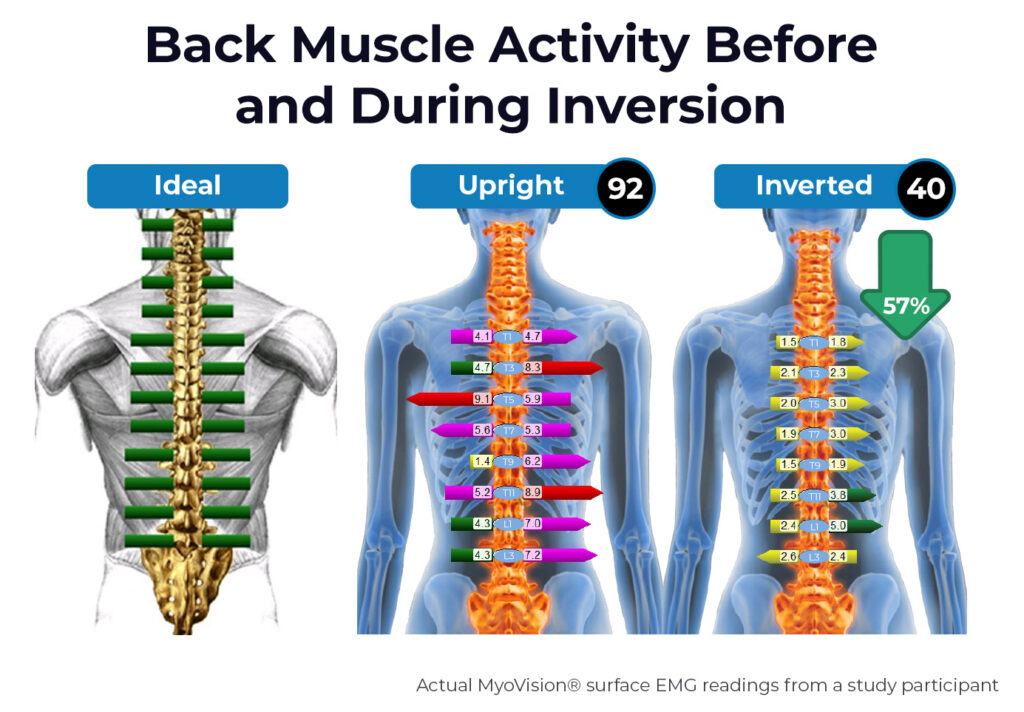 Graph depicting MyoVision® EMG readings of back muscle activity, highlighting a significant decrease during inversion.